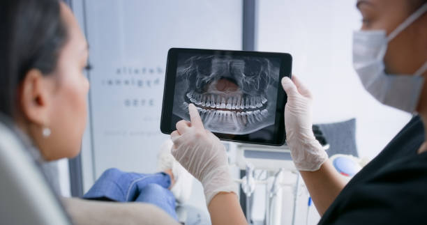 Licensed Teeth Whitening service in Perry, LA - Smile Center Dentistry